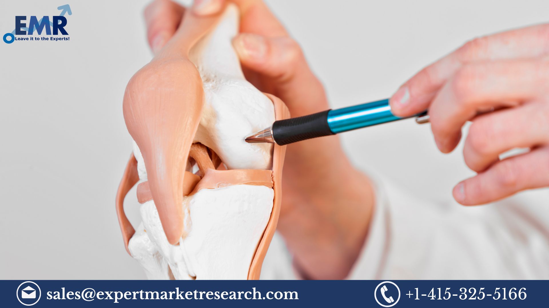 Knee Cartilage Repair Market