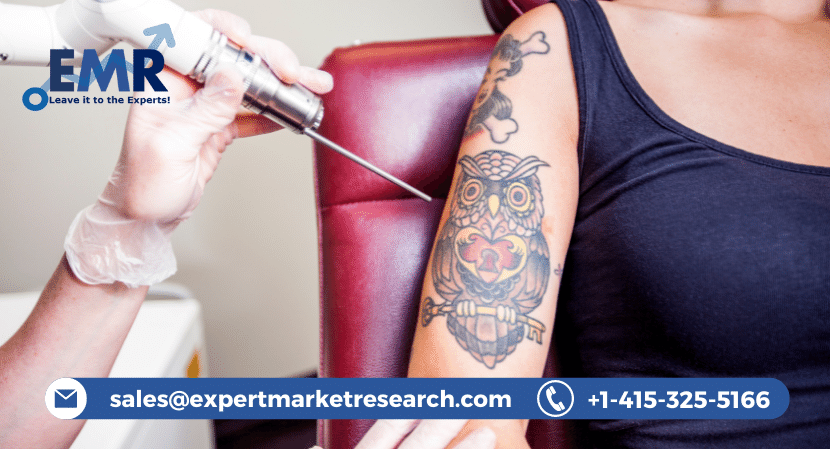 Tattoo Removal Market