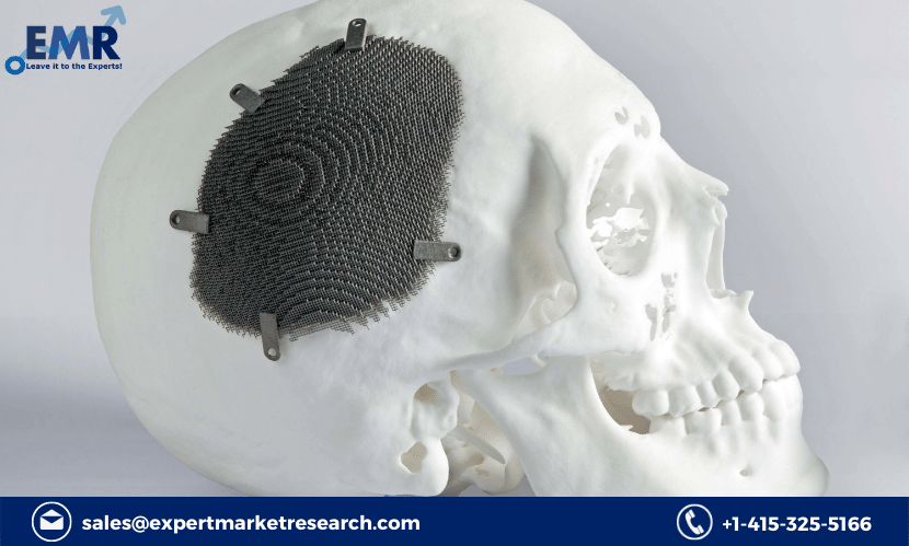 Cranial Implants Market