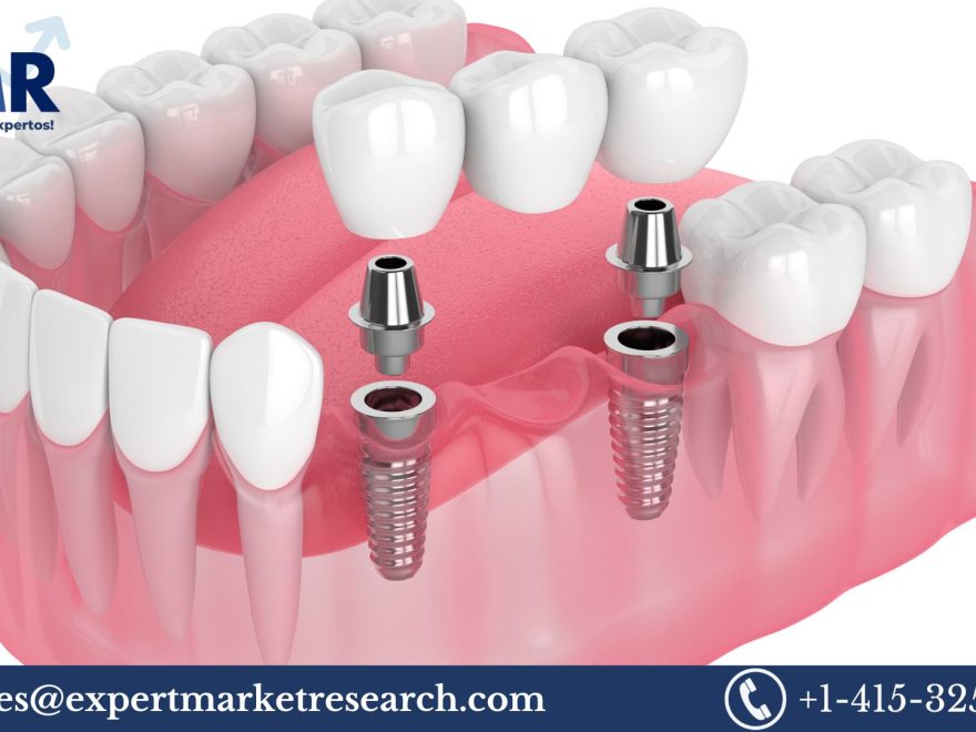 Dental Crowns and Bridges Market