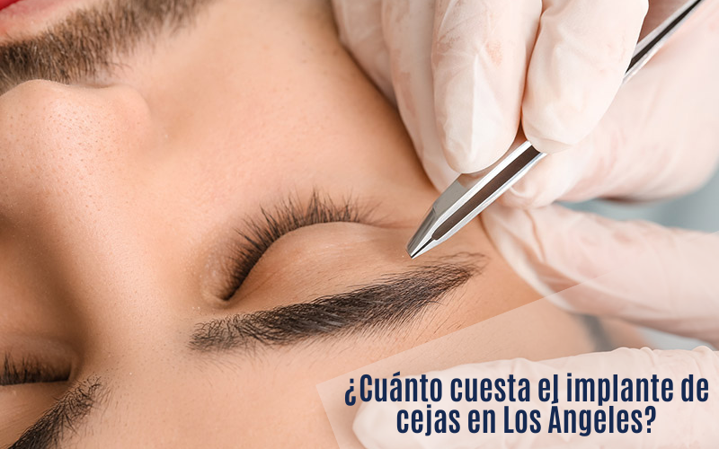 implante de cejas costo