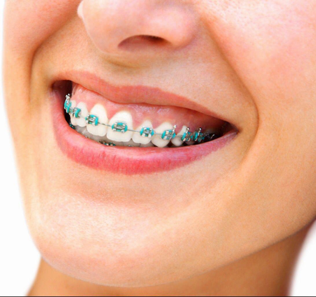 sky blue braces