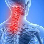 Neck pain