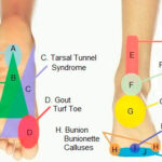 foot pain chart