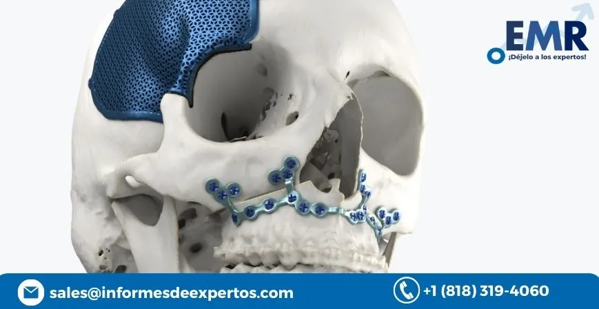 Global Craniomaxillofacial Implants Market