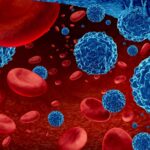 Hematologic Malignancies Market Analysis Report 2023-28