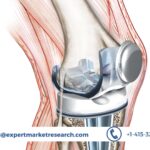 Knee Replacement Market Size