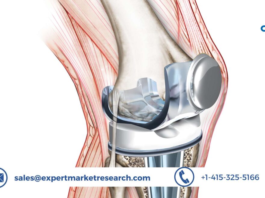 Knee Replacement Market Size