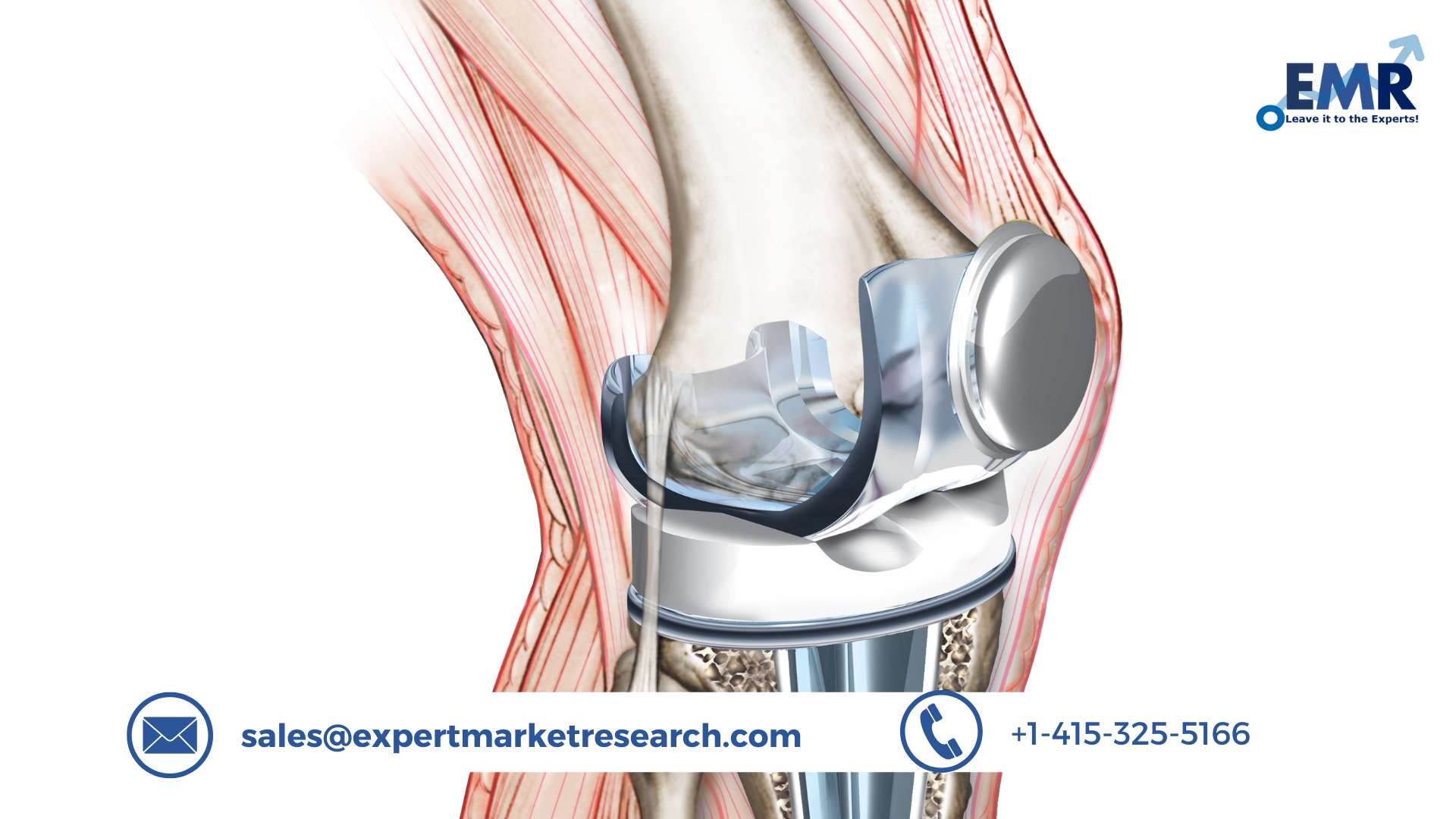 Knee Replacement Market Size