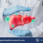 Liver Cancer Therapeutics Market