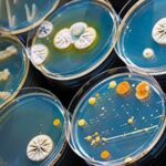 Microbial Identification Market Share and Growth Analysis by 2023-2028