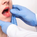 Gum Disease Treatment