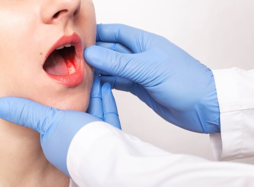 Gum Disease Treatment