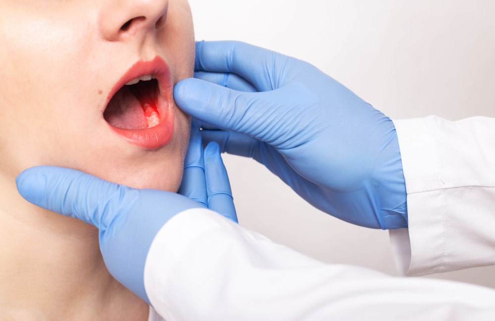 Gum Disease Treatment