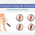 Prophylaxis of Deep Vein Thrombosis: A Comprehensive Review