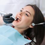 Teeth Cleaning