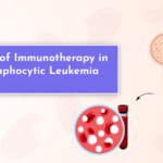 The Impact of Immunotherapy in Chronic Lymphocytic Leukemia Treatment