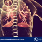 Tuberculosis Treatment Market