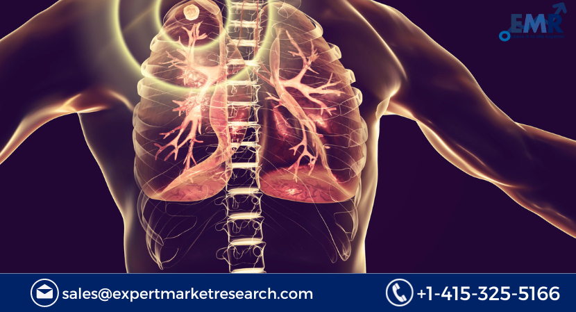 Tuberculosis Treatment Market