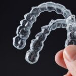 clear aligners