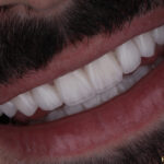 Hollywood Smile Dental Clinic in Dubai