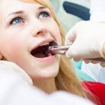 Tooth Extraction Specialist in Dubai