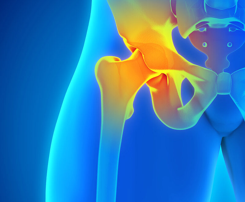 hip bursitis exercises to avoid