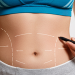 best tummy tuck surgeon in athens