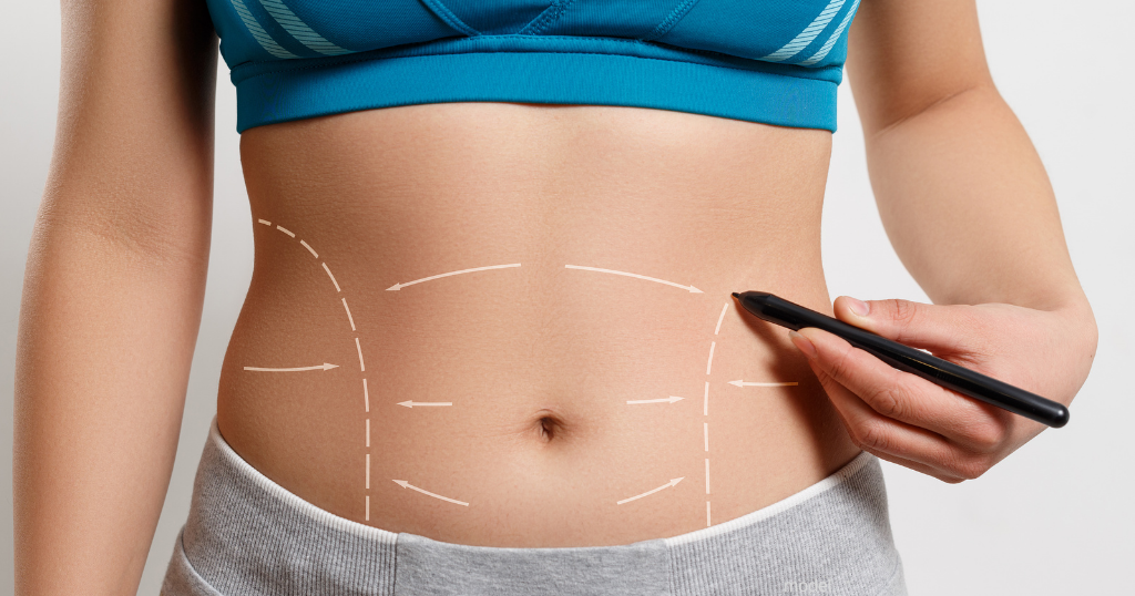 best tummy tuck surgeon in athens