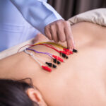 Ancient Wisdom Meets Modern Science: Electroacupuncture in Berkeley