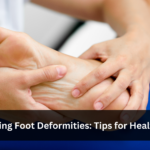 foot deformities