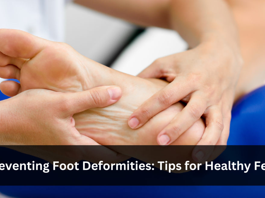 foot deformities