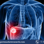 Liver Cancer Screening Market