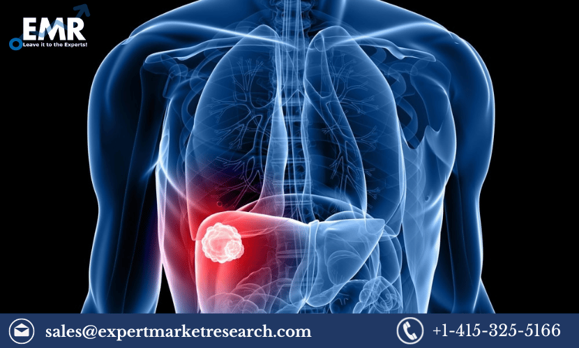 Liver Cancer Screening Market