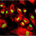 Mesenchymal Stem Cells Market 2023 | Growth and Forecast 2028