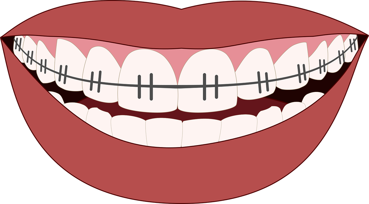 Orthodontiacs Bella Vista