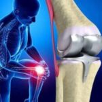 Orthopedic Digit Implants Market