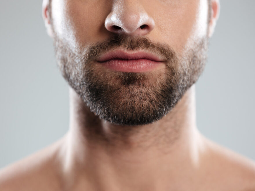 beard transplant