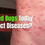 Can Bed Bugs Today Contract Diseases