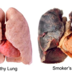 How does smoking affect your body?