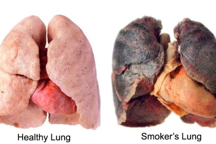 How does smoking affect your body?