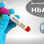 Hba1c