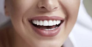 Dark Gums