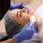 Unlocking Youthful Radiance: Exploring the Benefits of HIFU Therapy