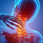 Neck Pain – Definition, Types & Best Treatment