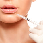 How to Prepare for Your Dermal Filler Appointment