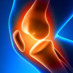 knee pain treatment