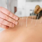 The Healing Power of Acupuncture: Exploring the Benefits and Process of this Ancient Treatment