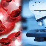 Cancer Diagnostics Market Size, Growth Report 2023-2028