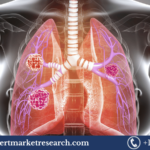 Cancer/Tumour Profiling Market